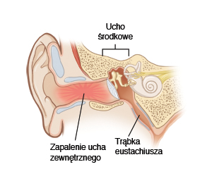 ucho środkowe, zapalenie ucha zewnętrznego, trąbka Eustachiusza