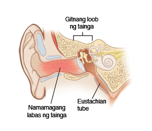 Gitnang loob ng tainga, Namamagang labas ng tainga, Eustachian tube