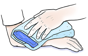 Primer plano de la mano de un adulto sosteniendo una compresa de hielo envuelta en una toalla sobre el antebrazo de un niño.